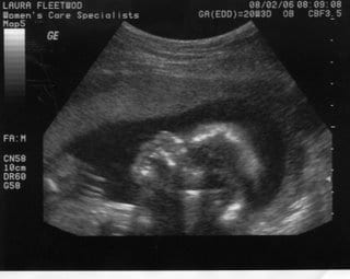 Behold, The Miracle of Anna Marie